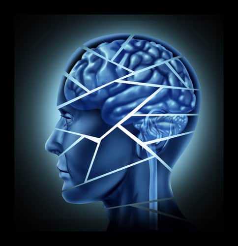 Head Injury vs Brain Injury vs TBI | TBI Lawyer